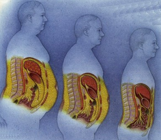 Viscelarni tuk